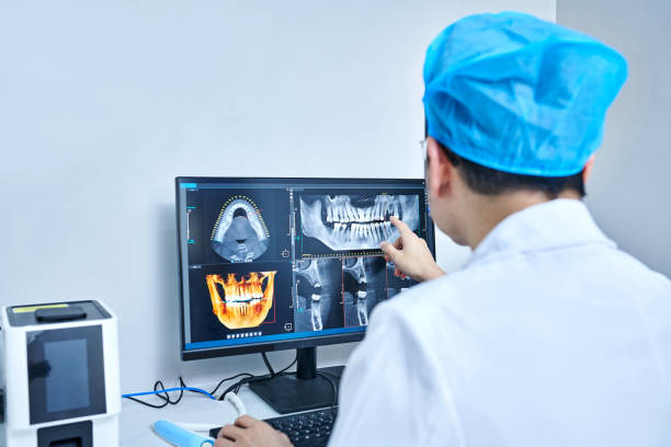 Best Emergency Wisdom Tooth Extraction in Salina, UT